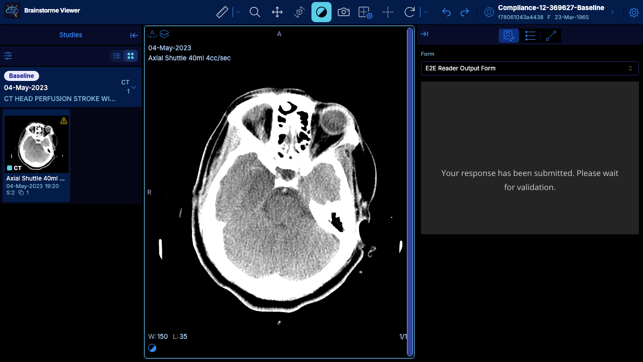 A processed study open in the viewer, with the series list on the left and the report panel on the right